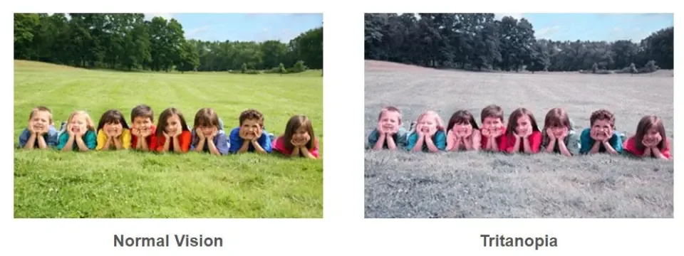 Colour Vision Deficiency — CVD, also known as colour blindness