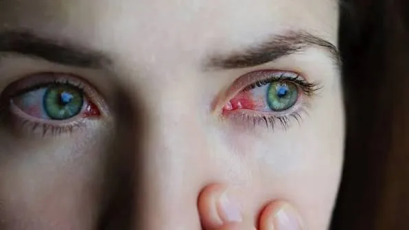 Diabetes related eye conditions including Diabetic Retinopathy