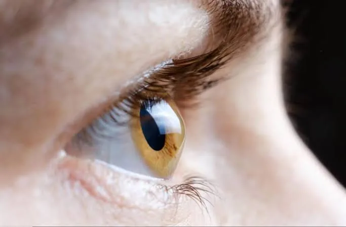 Fuchs' endothelial corneal dystrophy for Greater Independence in Everyday Life