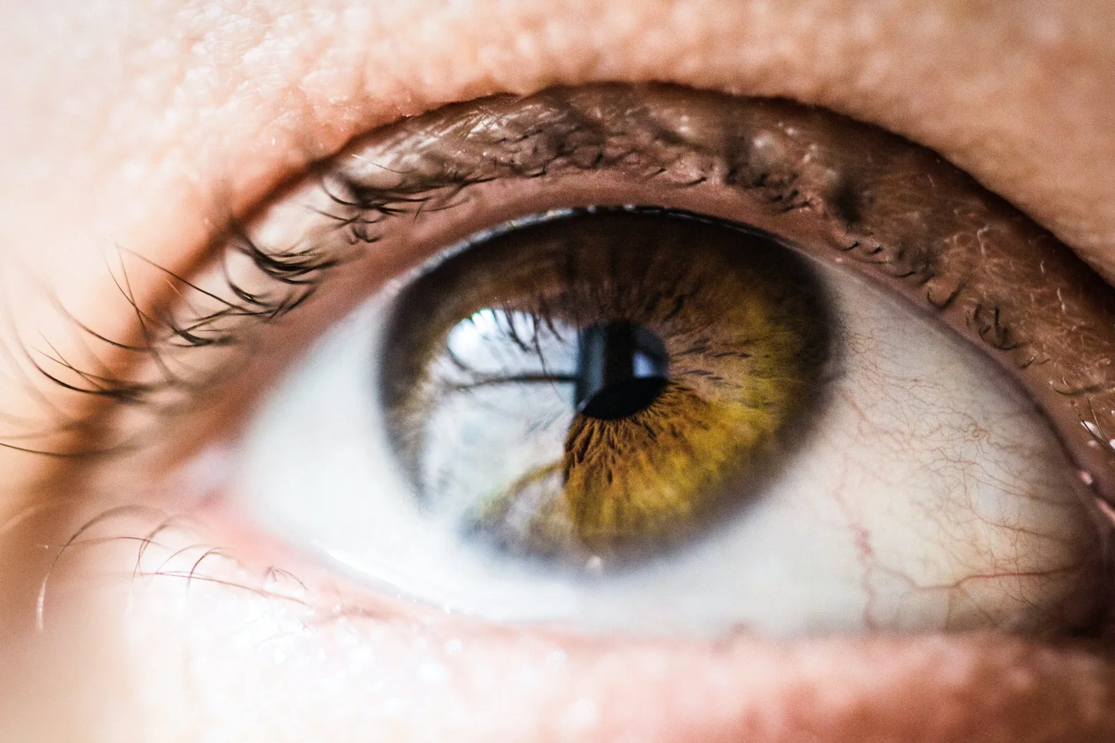 Fuchs' endothelial corneal dystrophy for Greater Independence in Everyday Life
