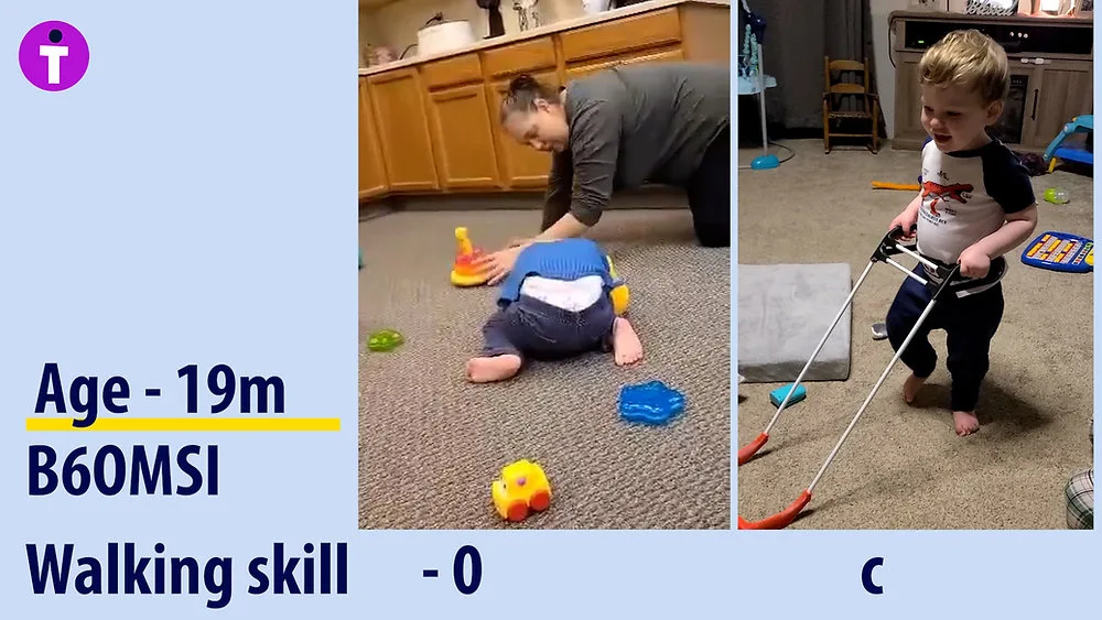 How to Start Orientation and Mobility Skills Before a Blind Baby Is Walking